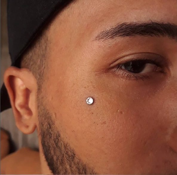 Microdermal